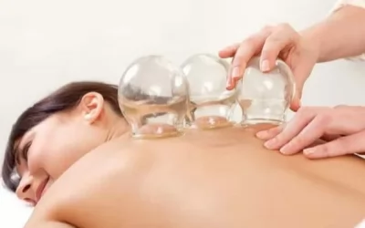 Cupping: Mengenal Cupping dan Manfaatnya bagi Tubuh